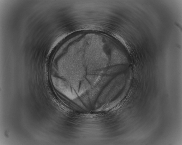 X0000097671120200803281007
