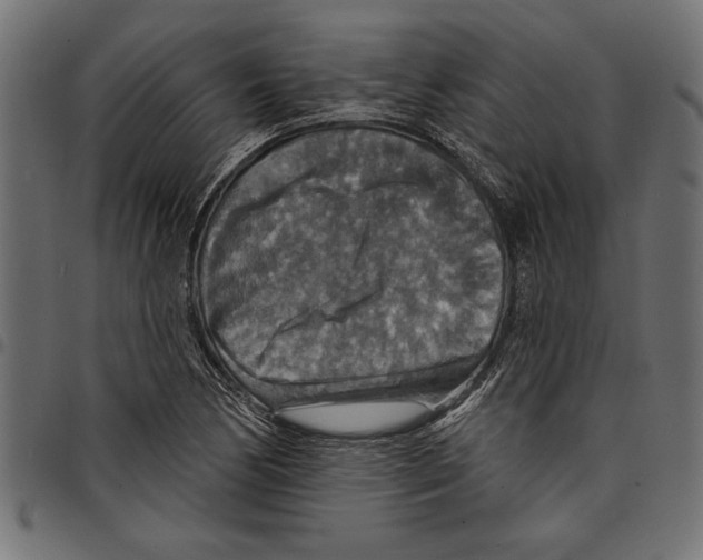 X0000097671170200803281006