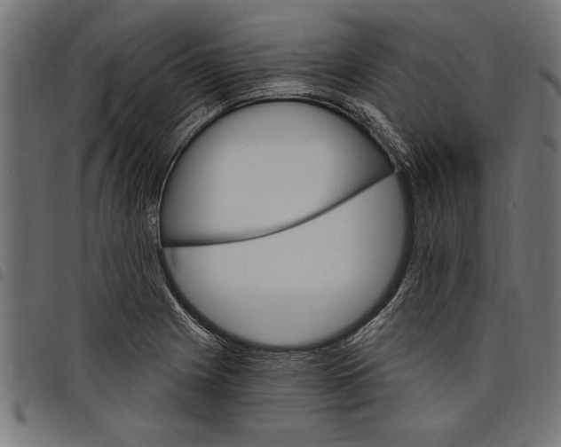 X0000097671225200803281005