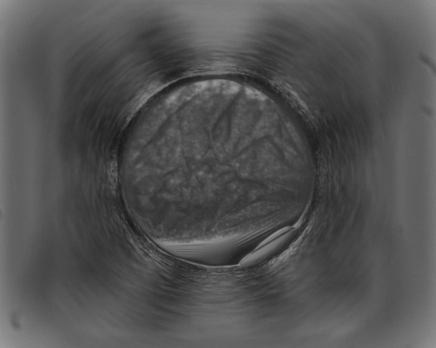 X0000097671457200803281002
