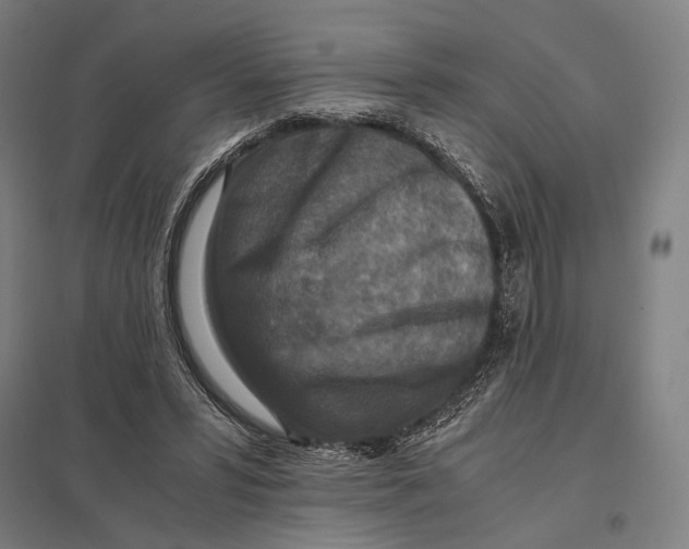 X0000097760399200803281639