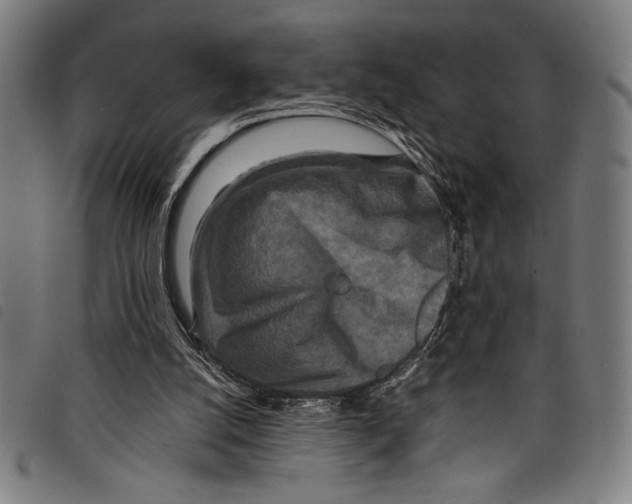 X0000097760056200804041134