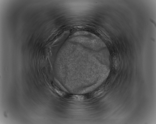 X0000097760328200804041131