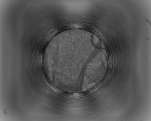 X0000097760330200804041131