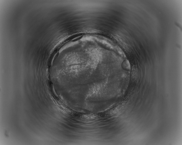 X0000097760351200804041131