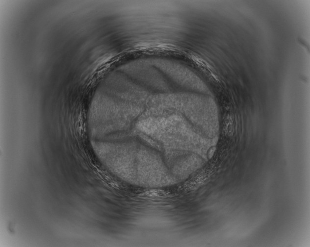 X0000097760966200804041122