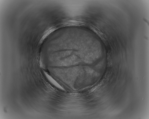 X0000097761453200804041115