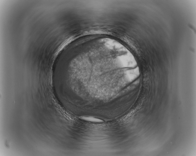 X0000097771173200803281633