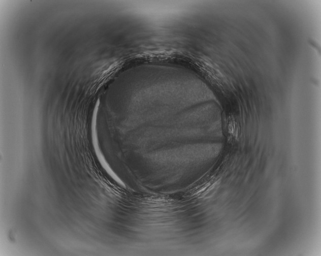 X0000097771252200803281632