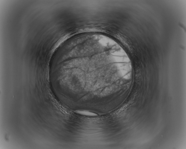 X0000097771173200804041146