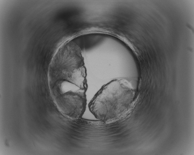 X0000097771413200804041142