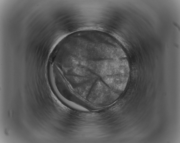 X0000097771468200804041142