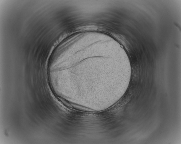 X0000097771475200804041141