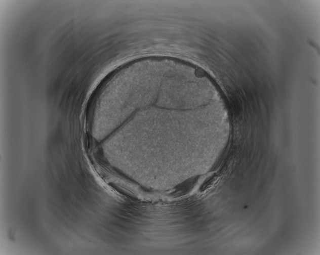 X0000097771515200804041141