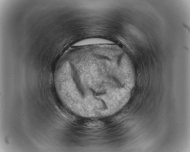 X0000097780459200803281705