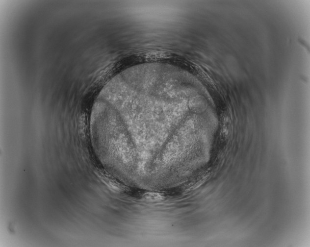 X0000097780519200803281704