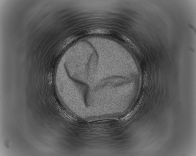 X0000097781017200804041209