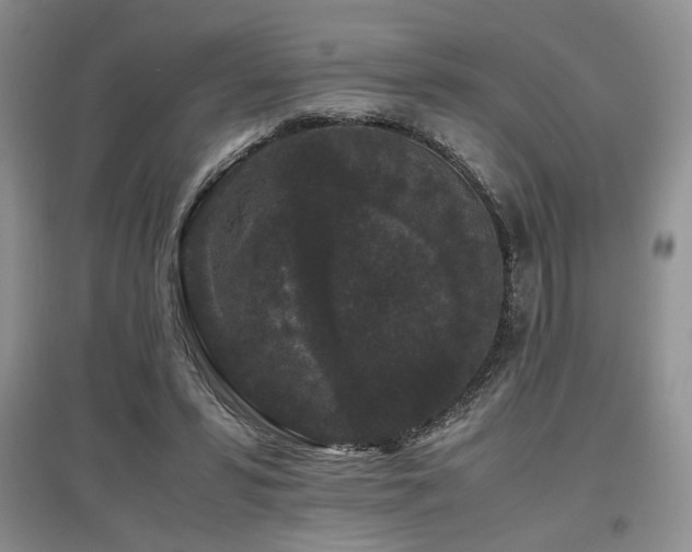 X0000097800399200803141058