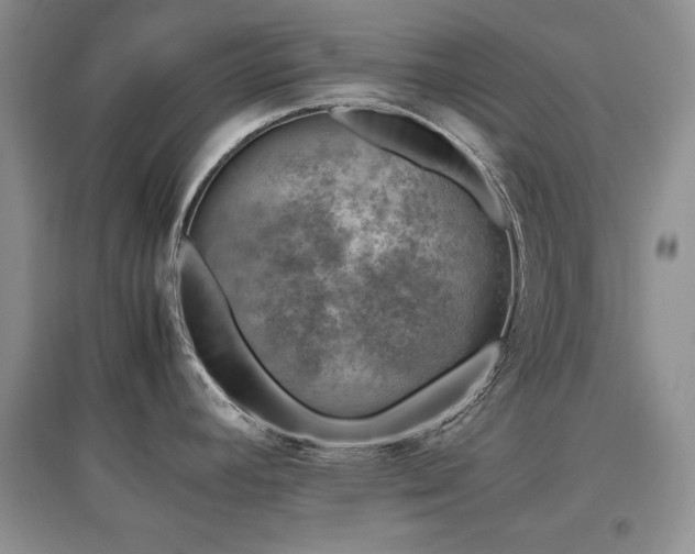 X0000097801392200803141044