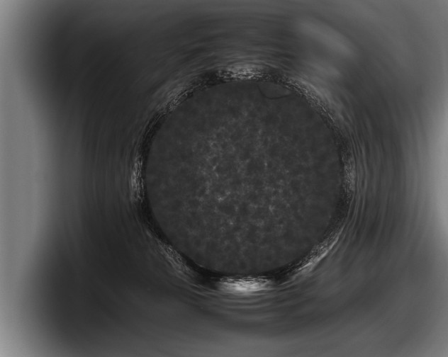 X0000097800181200803201405