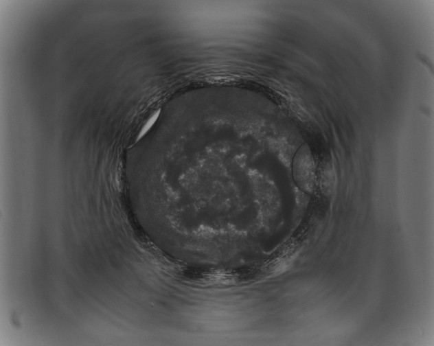 X0000097800319200804041320