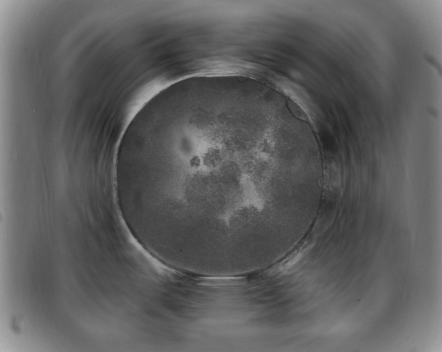 X0000097811487200803141107