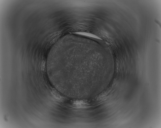 X0000097820177200804041407