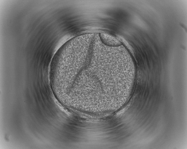 X0000097821386200804111005