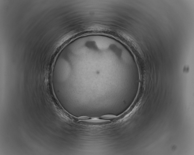 X0000097831017200803281155