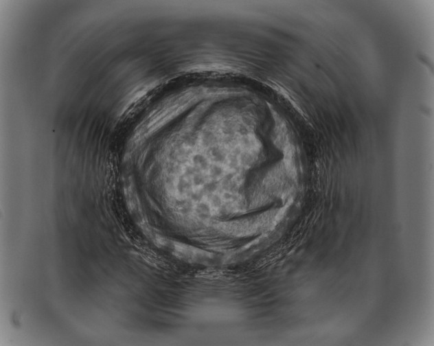 X0000097830967200804041418