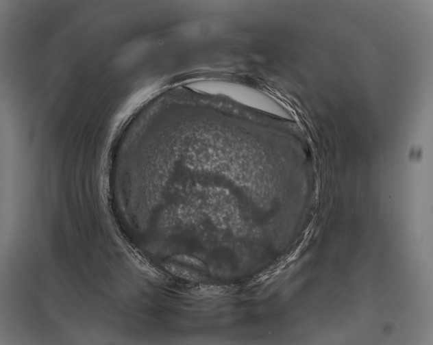 X0000097840149200803281232