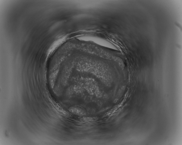 X0000097840149200804041451
