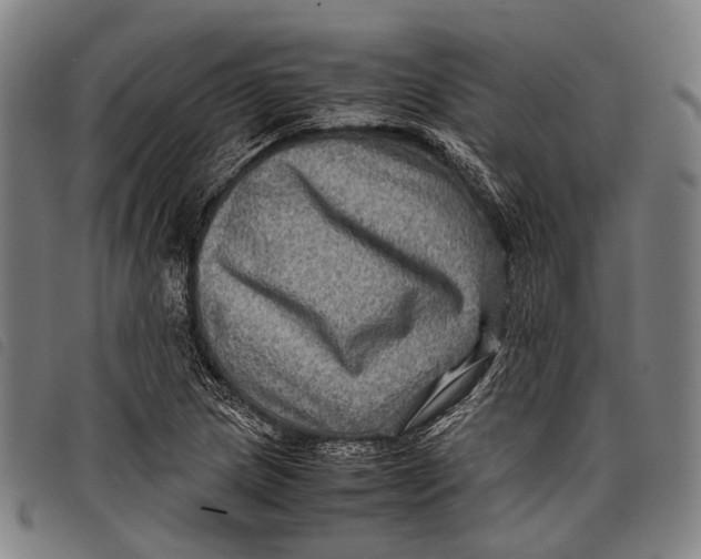 X0000097841217200804041436