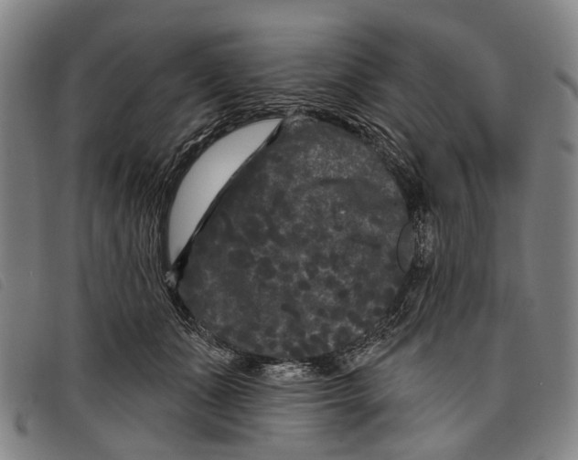 X0000097850511200804041509