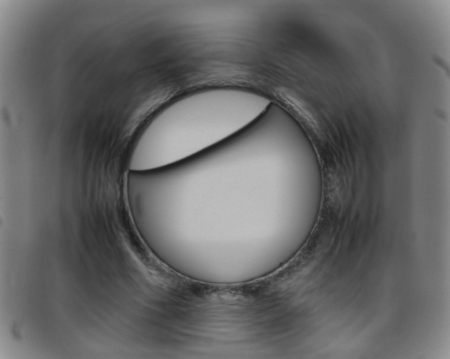 X0000097860586200803140858