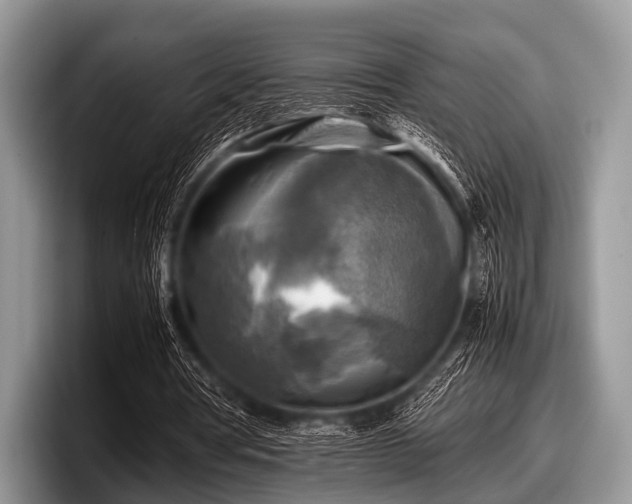 X0000097860386200803211258