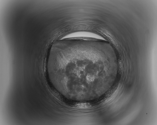 X0000097860499200803211257