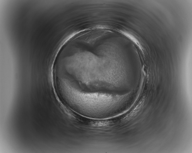 X0000097861047200803211250