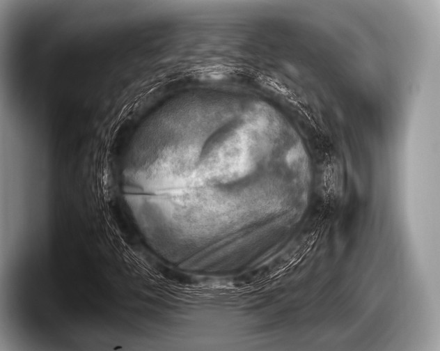 X0000097861446200803211245