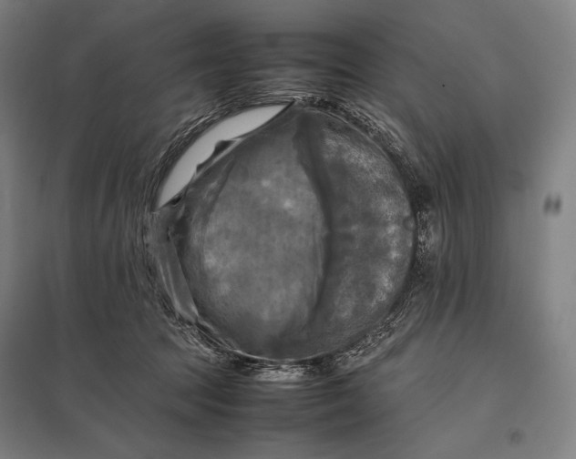 X0000097860369200803281317