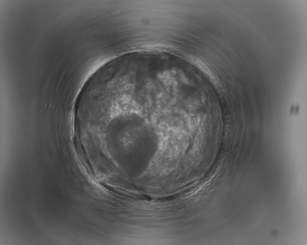 X0000097861079200803281307