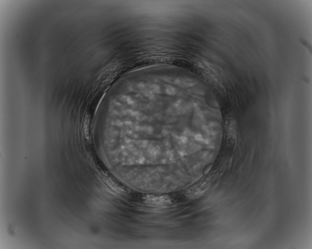 X0000097860185200804041536