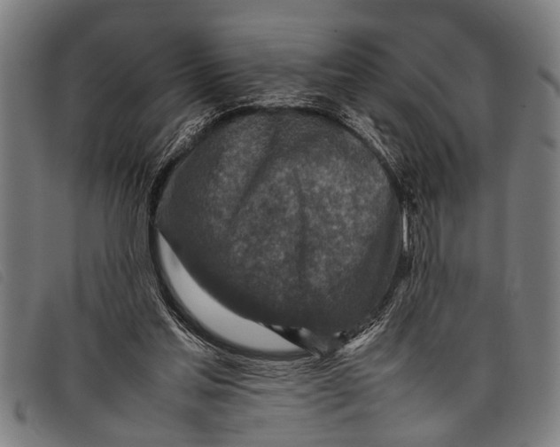 X0000097860205200804041535