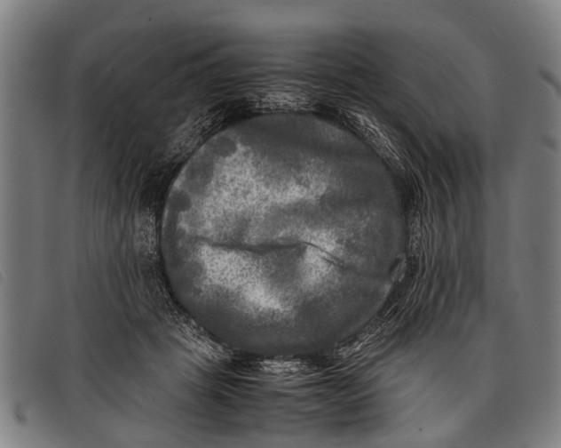 X0000097860457200804041532