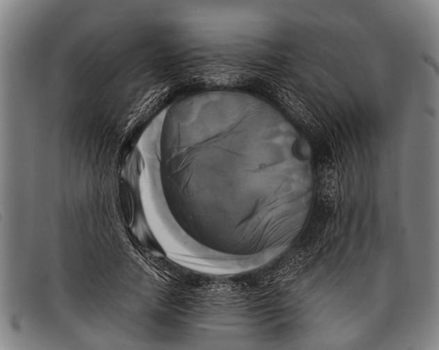 X0000097860738200804041528