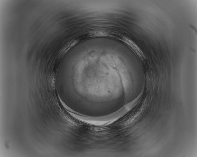 X0000097860857200804041527