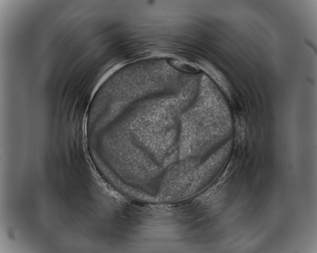 X0000097861198200804041522