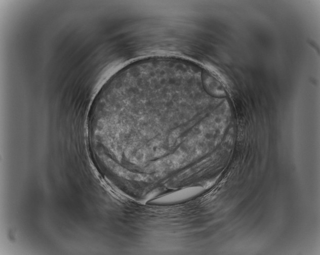 X0000097861287200804041520