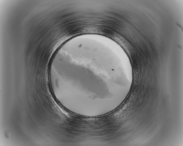 X0000097861141200804111146