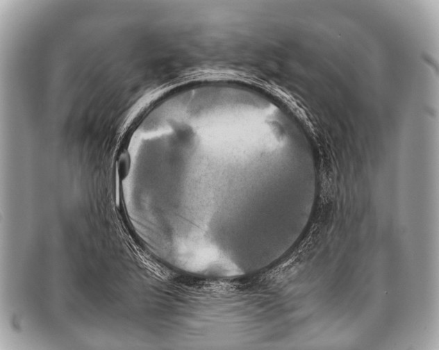 X0000097861175200804111145